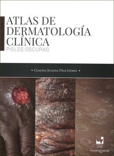 Libro: Atlas de dermatología clínica | Autor: Claudia Juliana Diaz Gomez | Isbn: 9786287523678