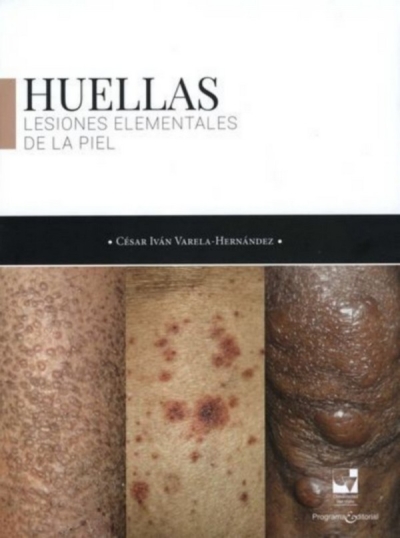 Libro: Huellas | Autor: Cesar Ivan Varela Hernandez | Isbn: 9786287523708