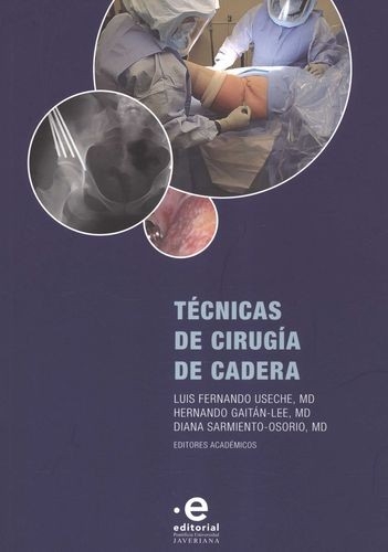 Libro: Técnicas de la cirugía de cadera | Autor: Varios | Isbn: 9789587818420